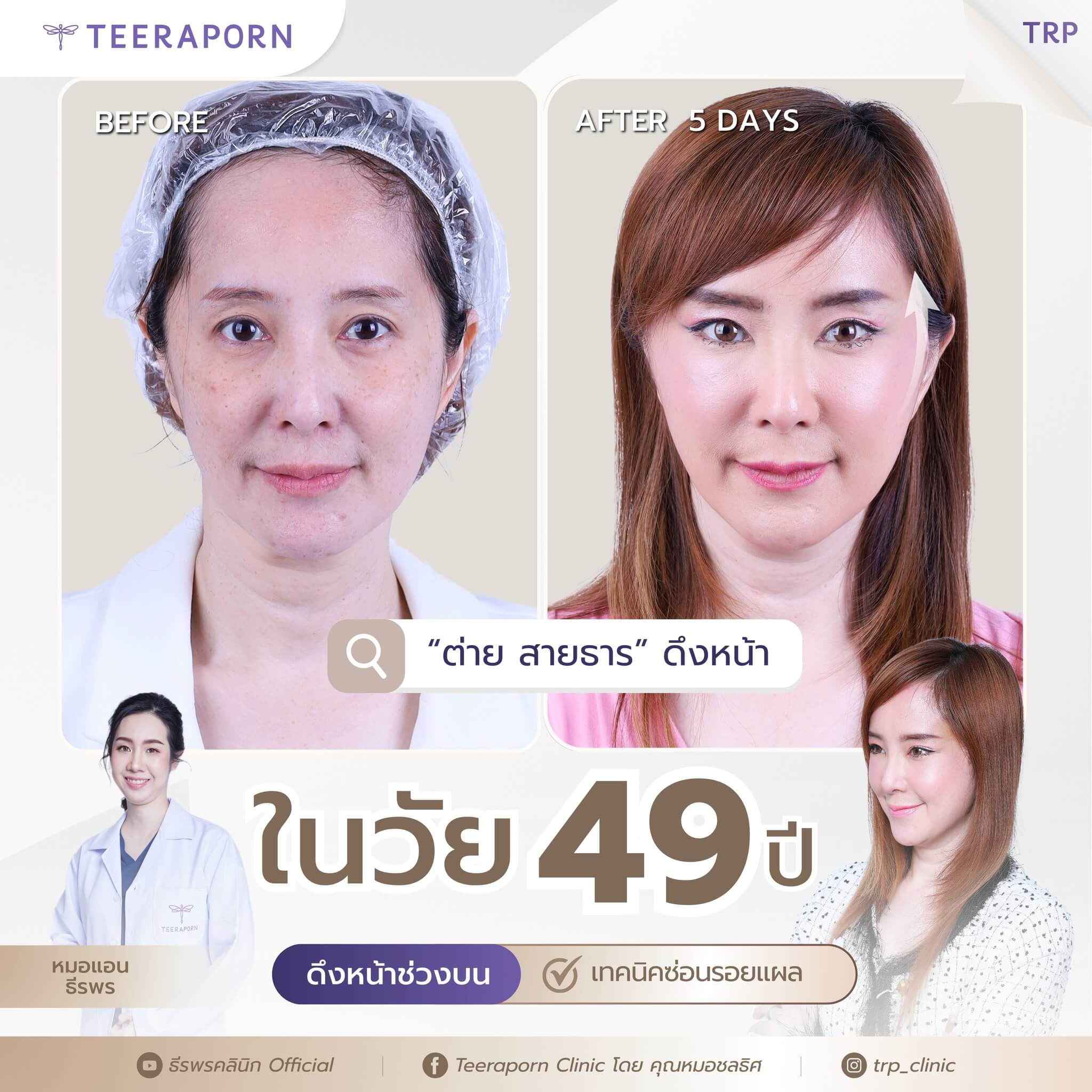 ดึงหน้าที่ไหนดี
