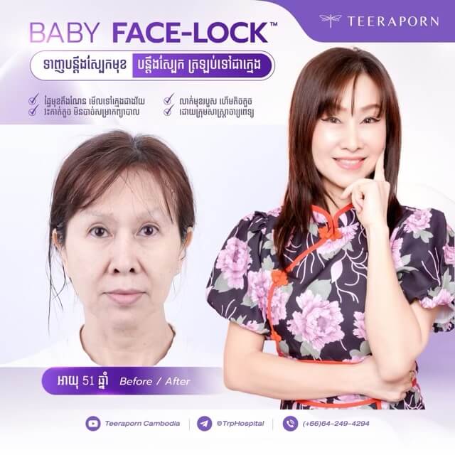 Face lock