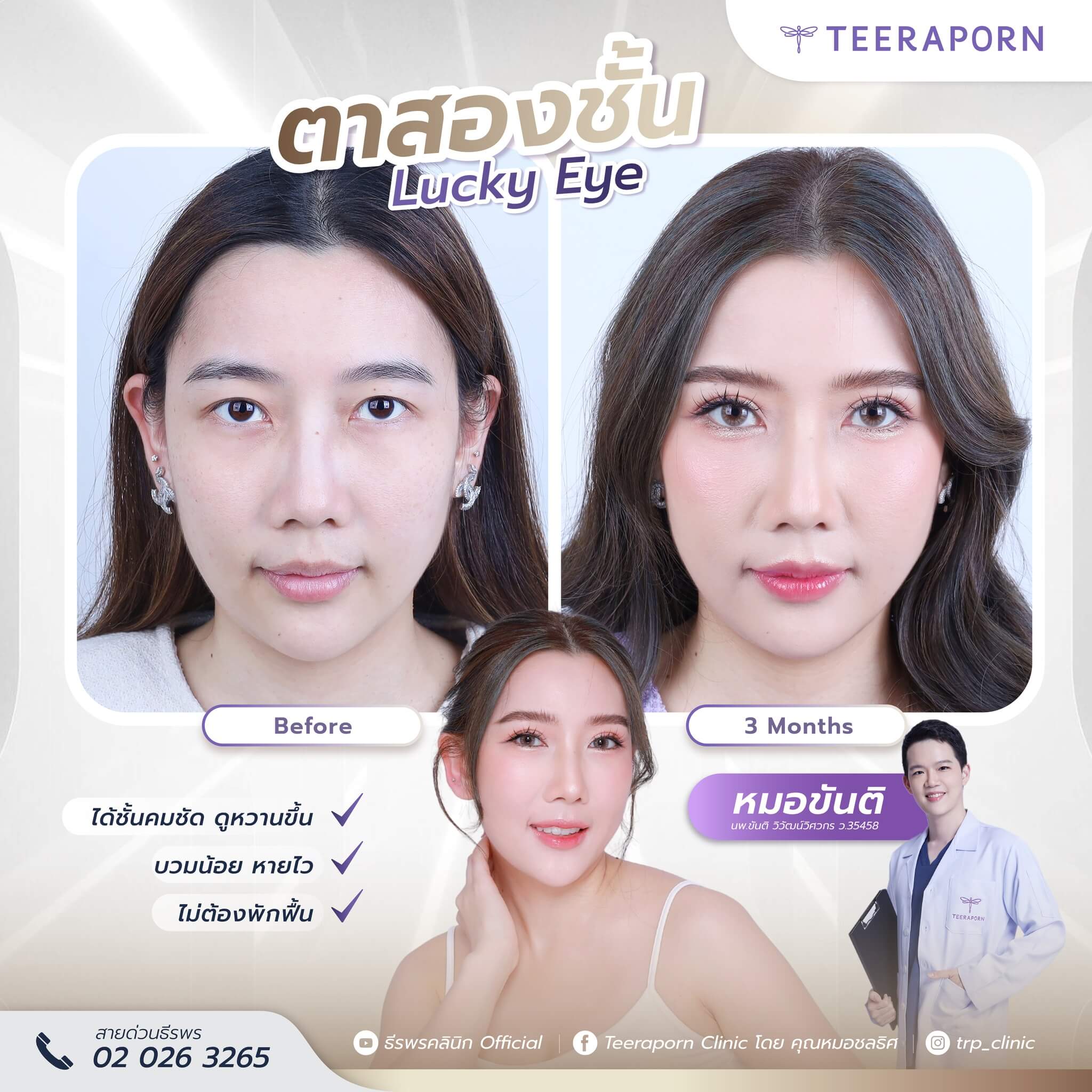รีวิวตาสองชั้น คุณชมพู