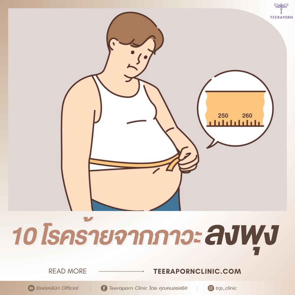 ลงพุง
