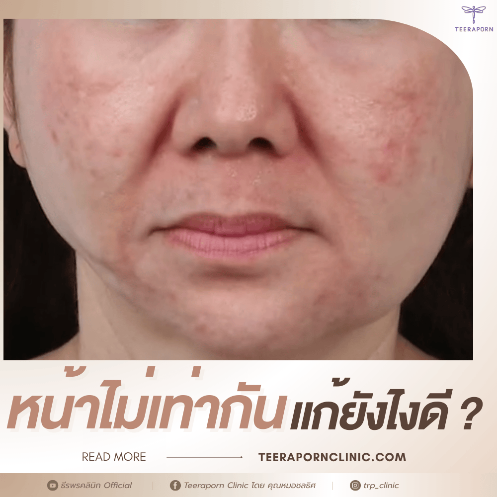 หน้าไม่เท่ากัน