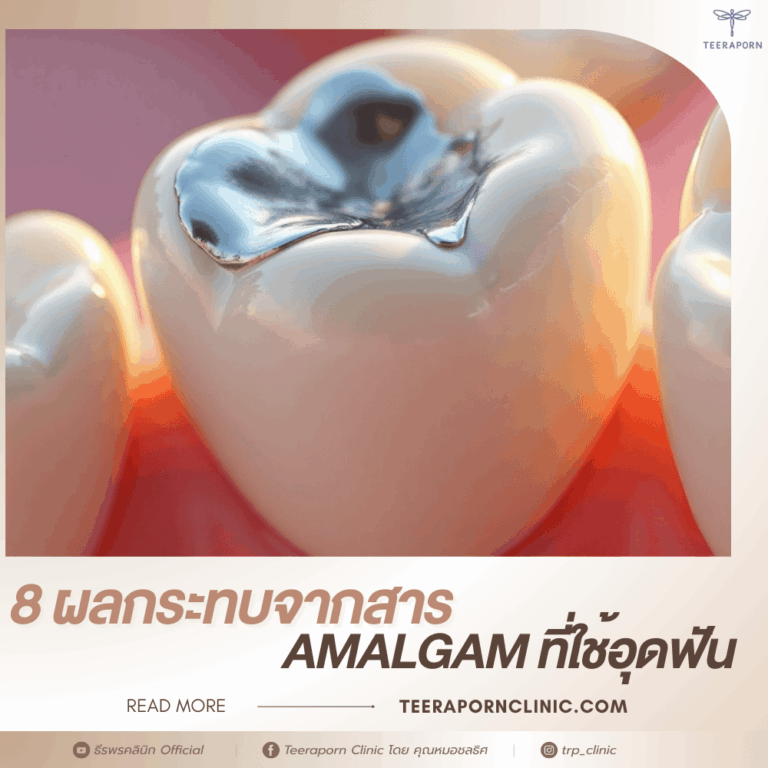 amalgam