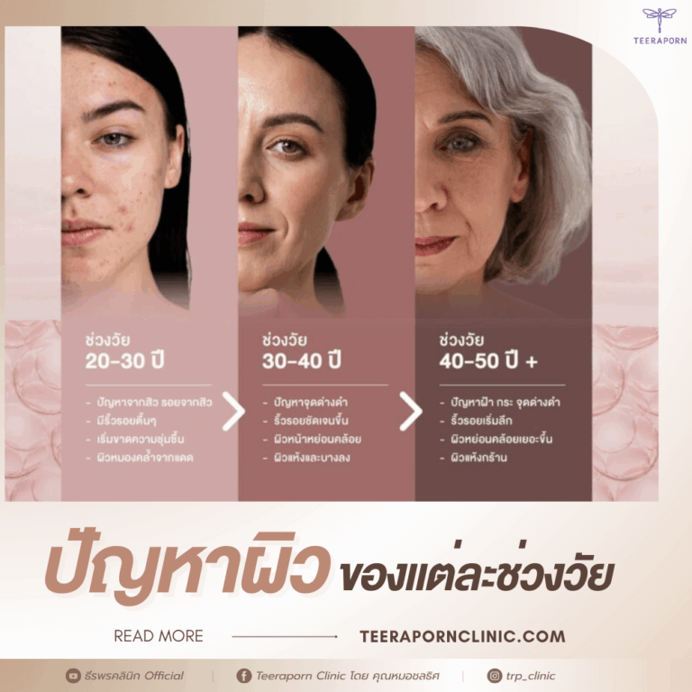 อายุ 50 หน้าหย่อนคล้อย