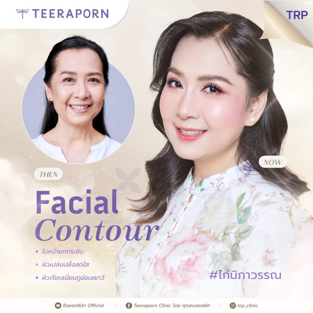 รีวิว ดึงหน้า + Facial Contour คุณไก่ นิภาวรรณ
