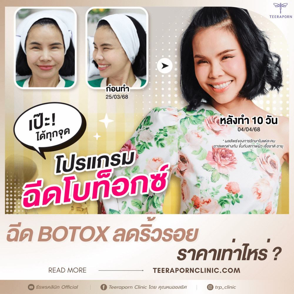ฉีดโบลดริ้วรอย ราคา
