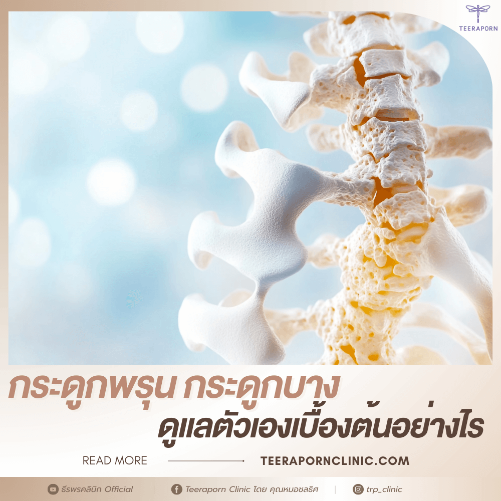 กระดูกพรุน กระดูกบาง