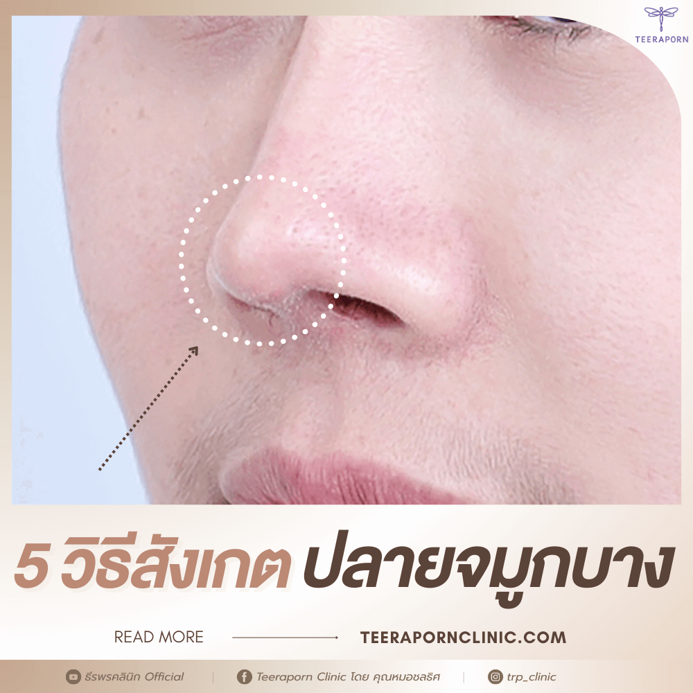 ปลายจมูกบาง