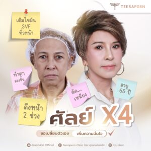 ศัลยกรรมดึงคอ 11 แพมมี่