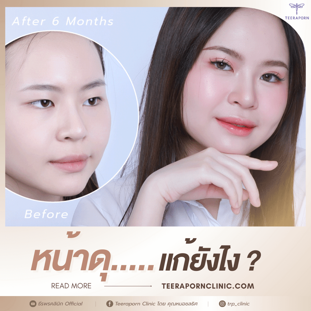หน้าดุ