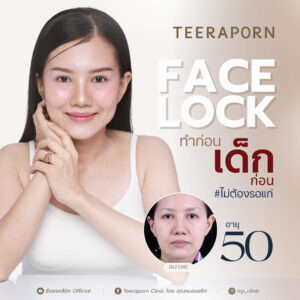 คุณปุ๊ค ดึงหน้า
