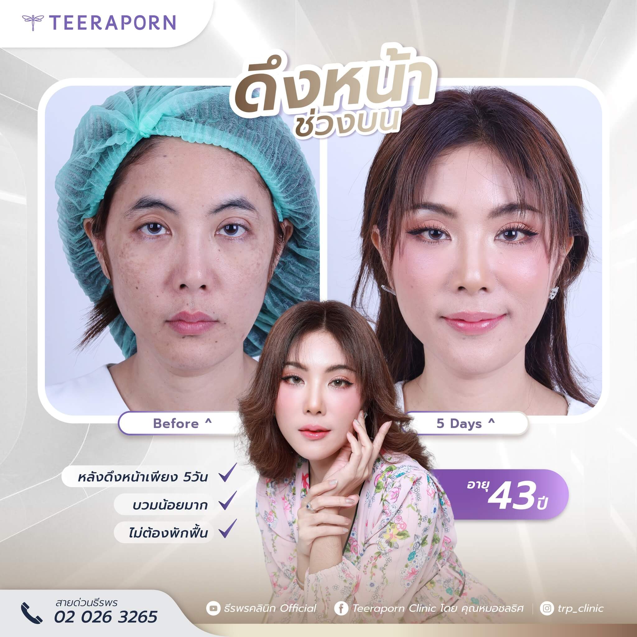 แอน สุภัคสิณี
