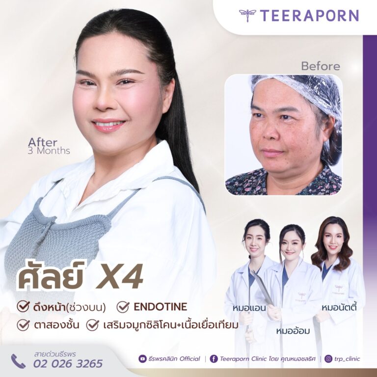 คุณแตง