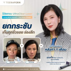 รีวิวโปรแกรม UltraClear คุณเปิ้ล หัทยา วงษ์กระจ่าง