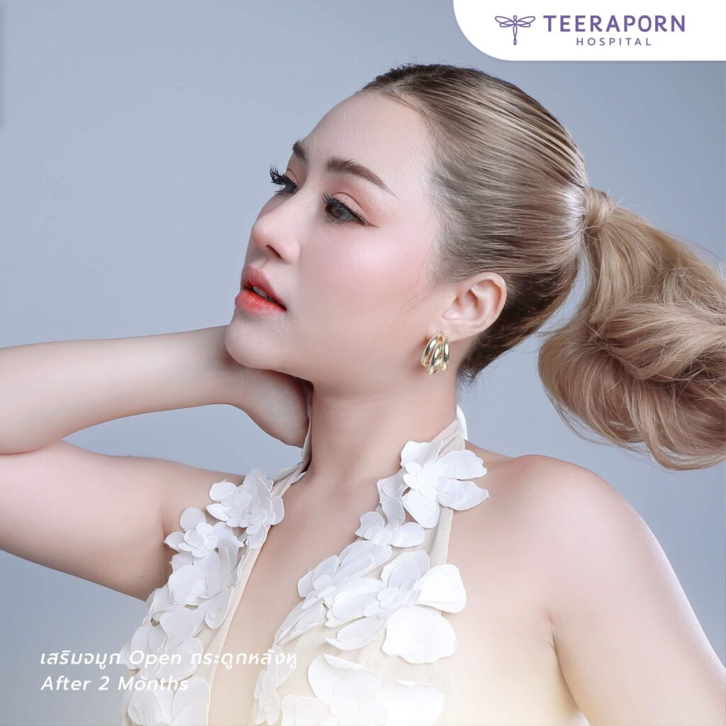 แก้จมูกเจ็บไหม pantip