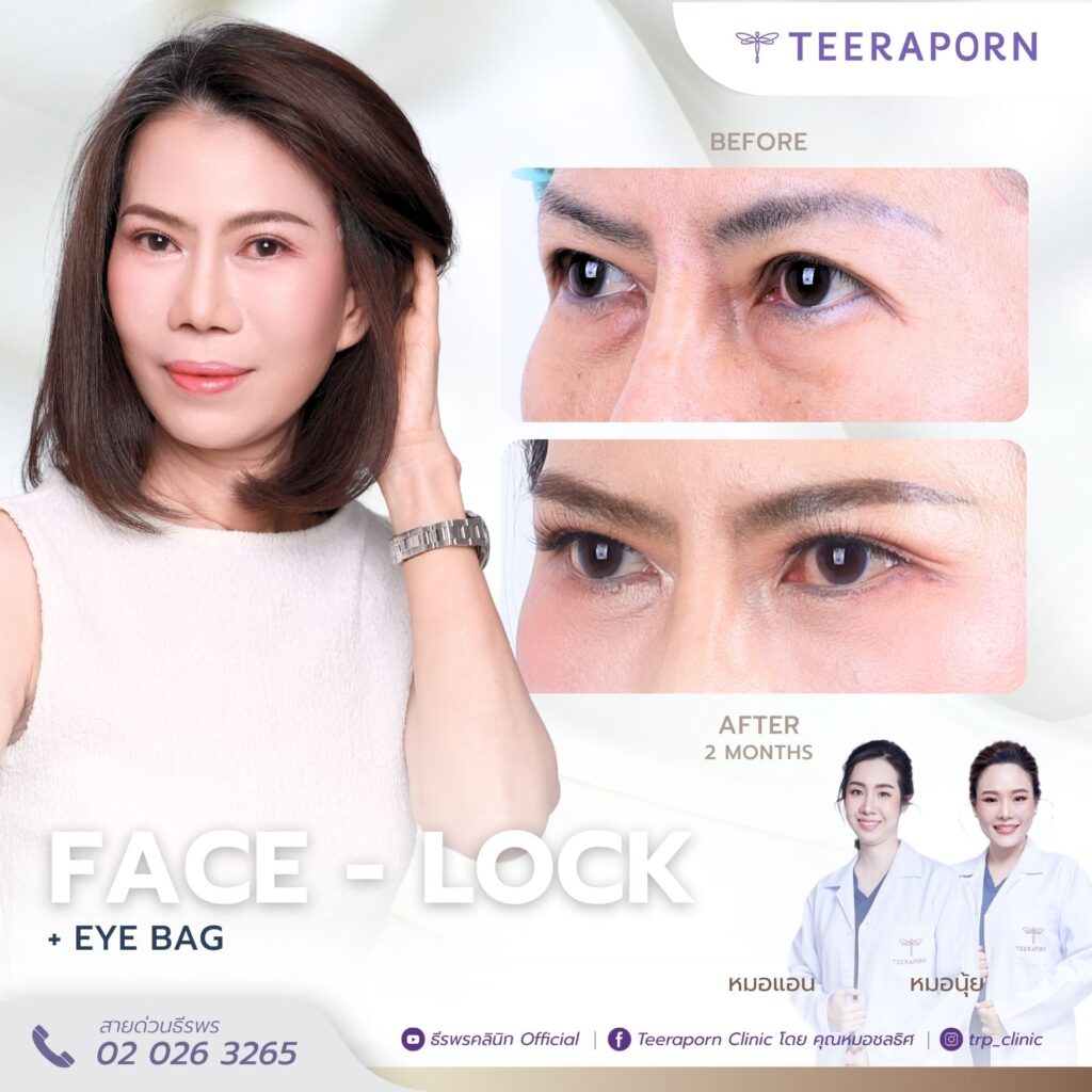 คุณก็อต