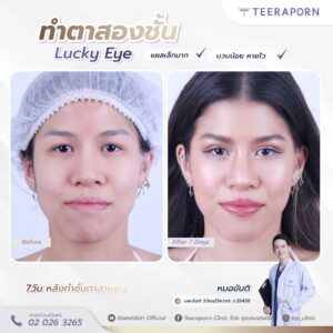 คุณเมลานี